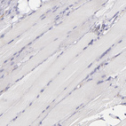 Anti-IRF8 Antibody