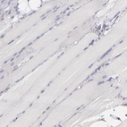 Immunohistochemical staining of human skeletal muscle shows no positivity in myocytes as expected.