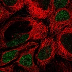 Immunofluorescent staining of human cell line CACO-2 shows localization to nucleoplasm.