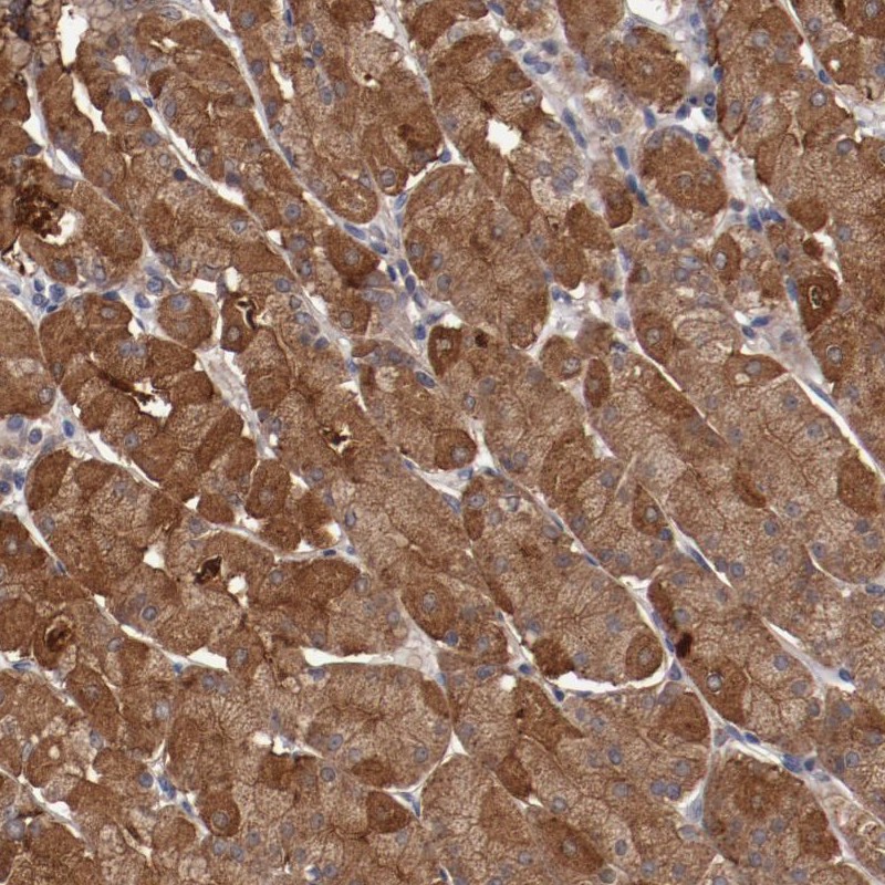 Anti-LRRC75B Antibody