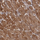 Anti-LRRC75B Antibody