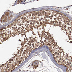 Anti-TXNDC16 Antibody