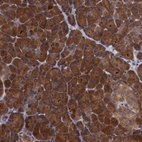 Immunohistochemical staining of human pancreas shows strong cytoplasmic positivity in exocrine glandular cells.