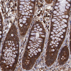 Immunohistochemical staining of human rectum shows strong cytoplasmic positivity in glandular cells.