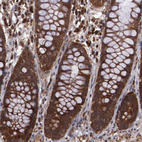 Anti-TXNDC16 Antibody