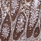 Immunohistochemical staining of human rectum shows strong cytoplasmic positivity in glandular cells.