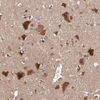 Immunohistochemical staining of human cerebral cortex shows strong cytoplasmic positivity in neurons.