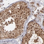 Anti-HUWE1 Antibody