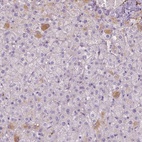 Immunohistochemical staining of human liver shows low expression as expected.