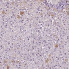 Immunohistochemical staining of human liver shows low expression as expected.