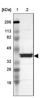 Lane 1: Marker [kDa] 206, 113, 82, 49, 32, 26, 18_br/_Lane 2: Human cell line RT-4