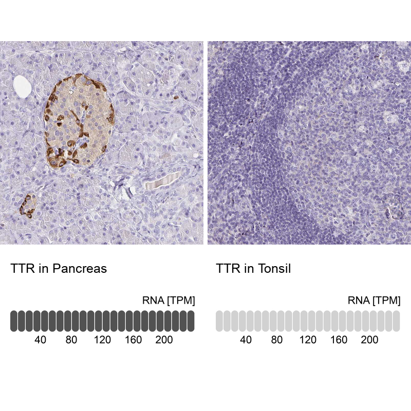 Anti-TTR Antibody