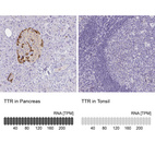 Anti-TTR Antibody