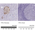 Anti-TTR Antibody