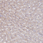 Immunohistochemical staining of human skeletal muscle shows no cytoplasmic positivity in myocytes as expected.