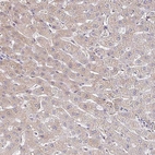 Immunohistochemical staining of human liver shows moderate cytoplasmic positivity in hepatocytes.