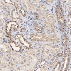 Anti-FMNL3 Antibody