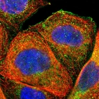 Immunofluorescent staining of human cell line A-431 shows localization to plasma membrane, cytosol, the Golgi apparatus & vesicles.