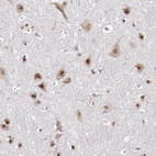 Anti-DDX24 Antibody