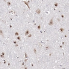 Immunohistochemical staining of human cerebral cortex shows strong nuclear positivity in neurons.