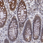Immunohistochemical staining of human rectum shows moderate positivity in nucleoli and cytoplasm in glandular cells.