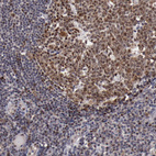 Anti-DDX24 Antibody