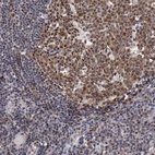 Immunohistochemical staining of human lymphoid tissues shows strong nucleolar positivity in germinal center cells.