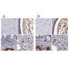 Anti-SERPINA3 Antibody