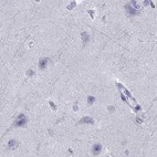 Anti-SERPINA3 Antibody