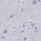 Immunohistochemical staining of human cerebral cortex using Anti-SERPINA3 antibody HPA002560.