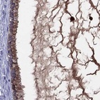 Anti-SERPINA3 Antibody