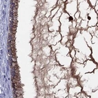 Immunohistochemical staining of human cervix, uterine using Anti-SERPINA3 antibody HPA002560.