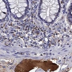 Immunohistochemical staining of human colon using Anti-SERPINA3 antibody HPA002560.
