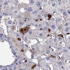 Anti-SERPINA3 Antibody