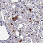 Immunohistochemical staining of human liver using Anti-SERPINA3 antibody HPA002560.