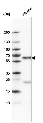 Western blot analysis in human plasma.