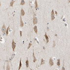 Anti-EIF1AX Antibody