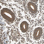 Immunohistochemical staining of human endometrium shows strong cytoplasmic positivity in glandular cells.