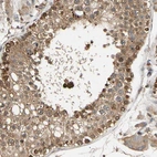 Immunohistochemical staining of human testis shows moderate to strong cytoplasmic positivity in cells in seminiferous ducts.