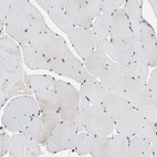 Immunohistochemical staining of human skeletal muscle shows no positivity in myocytes as expected.