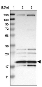 Lane 1: Marker [kDa] 230, 130, 95, 72, 56, 36, 28, 17, 11_br/_Lane 2: Human cell line RT-4_br/_Lane 3: Human cell line U-251MG sp