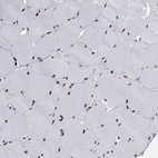Immunohistochemical staining of human skeletal muscle shows low expression as expected.