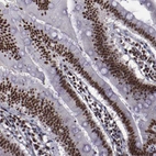 Immunohistochemical staining of human small intestine shows strong nuclear positivity in glandular cells.