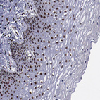 Immunohistochemical staining of human cervix shows strong nuclear positivity in squamous epithelial cells.
