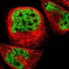 Immunofluorescent staining of human cell line A-431 shows localization to nucleoplasm.