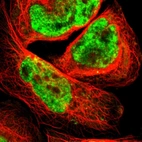 Immunofluorescent staining of human cell line A-431 shows localization to nucleoplasm.