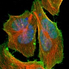 Immunofluorescent staining of human cell line U-2 OS shows localization to nucleus & plasma membrane.