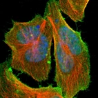 Immunofluorescent staining of human cell line U-2 OS shows localization to nucleus & plasma membrane.