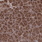 Anti-TRIP11 Antibody