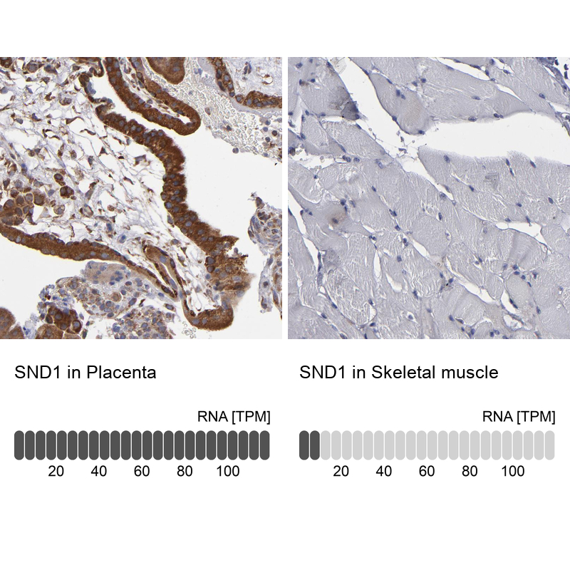 Anti-SND1 Antibody